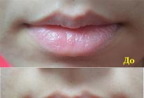 Как увлажнять губы в домашних условиях?